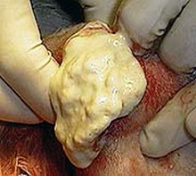 PASTEURELOZA IEPURILOR 5