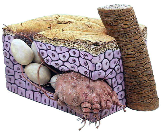 Raia la Porci - acaroza sau raia sarcoptica - sarcoptes-scabiei varietatea suis